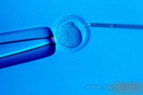 二代供卵试管婴儿_供卵生子的风险_试管婴儿知识普及 | 该如何选择促排卵方案
